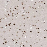 Anti-YAF2 antibody produced in rabbit 