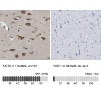 Anti-YARS antibody produced in rabbit