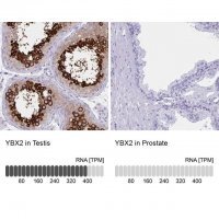 Anti-YBX2 antibody produced in rabbit 