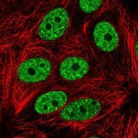 Anti-YLPM1 antibody produced in rabbit HPA061123-100UL