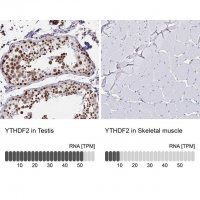 Anti-YTHDF2 antibody produced in rabbit