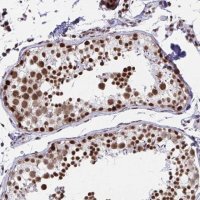 Anti-YTHDF2 antibody produced in rabbit