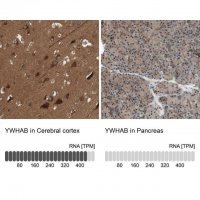 Anti-YWHAB antibody produced in rabbit 