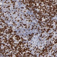 Anti-ZAP70 antibody produced in rabbit 