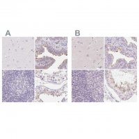 Anti-ZBBX antibody produced in rabbit