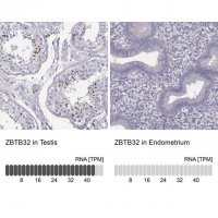 Anti-ZBTB32 