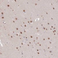 Anti-ZBTB7A antibody produced in rabbit 