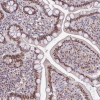 Anti-ZBTB7A antibody produced in rabbit