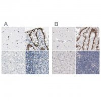 Anti-ZBTB7B antibody produced in rabbit 