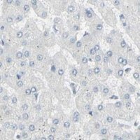 Anti-ZBTB7B antibody produced in rabbit 