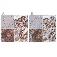 Anti-ZC3H18 antibody produced in rabbit 