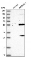 Anti-ZCCHC12 antibody produced in rabbit HPA031016-100UL