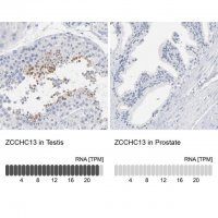 Anti-ZCCHC13 antibody produced in rabbit HPA003382-100UL