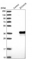 Anti-ZCCHC9 antibody produced in rabbit 