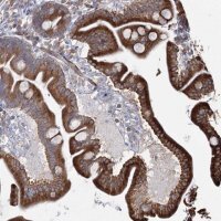 Anti-ZCCHC9 antibody produced in rabbit 