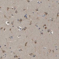 Anti-ZDHHC17 antibody produced in rabbit