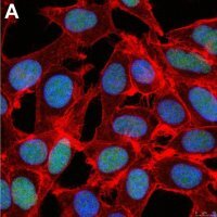 Anti-ZEB1 Antibody, clone 5C20 ZooMAb� Rabbit Monoclonal 