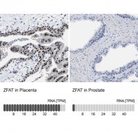 Anti-ZFAT antibody produced in rabbit