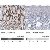 Anti-ZFPM1 antibody produced in rabbit 