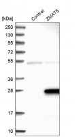 Anti-ZMAT5 antibody produced in rabbit HPA004858-100UL