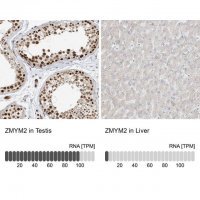 Anti-ZMYM2 antibody produced in rabbit 