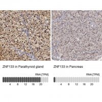 Anti-ZNF133 antibody produced in rabbit