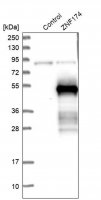 Anti-ZNF174 antibody produced in rabbit
