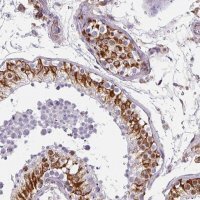 Anti-ZNF280C antibody produced in rabbit HPA051494-100UL