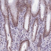 Anti-ZNF317 antibody produced in rabbit