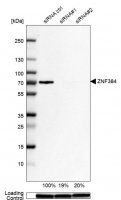Anti-ZNF384 antibody produced in rabbit 
