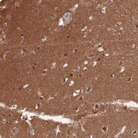Anti-ZNF436 antibody produced in rabbit HPA043817-100UL