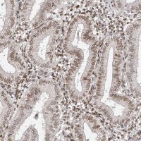 Anti-ZNF503 antibody produced in rabbit 