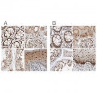 Anti-ZNF521 antibody produced in rabbit 