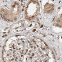 Anti-ZNF521 antibody produced in rabbit 