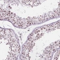 Anti-ZNF572 antibody produced in rabbit