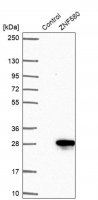 Anti-ZNF580 antibody produced in rabbit 