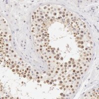 Anti-ZNF597 antibody produced in rabbit 