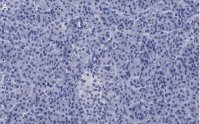 Anti-ZNF598 Antibody, clone 3N7, ZooMAb� Rabbit Monoclonal 