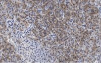Anti-ZNF598 Antibody, clone 3N7, ZooMAb� Rabbit Monoclonal 