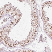 Anti-ZNF610 antibody produced in rabbit 