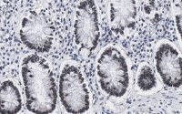 Anti-ZNF638 Antibody, clone 4C19 ZooMAb� Rabbit Monoclonal 