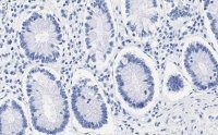 Anti-ZNF638 Antibody, clone 4C19 ZooMAb� Rabbit Monoclonal 