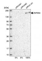 Anti-ZNF654 antibody produced in rabbit HPA036173-100UL