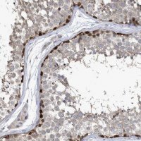 Anti-ZNF654 antibody produced in rabbit HPA036173-100UL