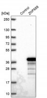 Anti-ZNF688 antibody produced in rabbit 