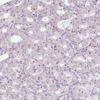 Anti-ZNF688 antibody produced in rabbit 