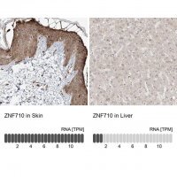 Anti-ZNF710 antibody produced in rabbit 