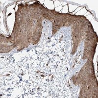 Anti-ZNF710 antibody produced in rabbit 