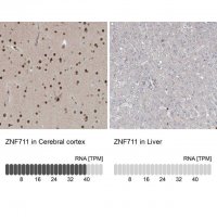 Anti-ZNF711 antibody produced in rabbit