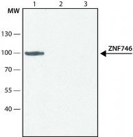 Anti-ZNF746 (C-terminal region) antibody produced in rabbit SAB4200531-200UL